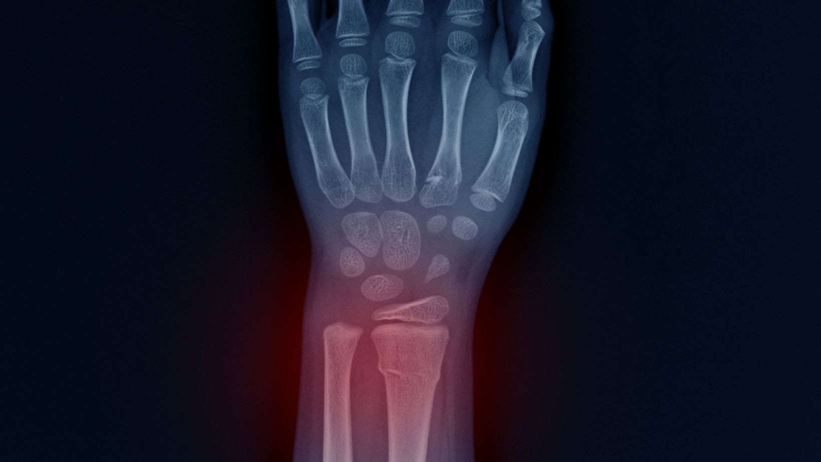 Examine The Causes of Left Wrist Pain ICD 10 Code - Decorator Advice